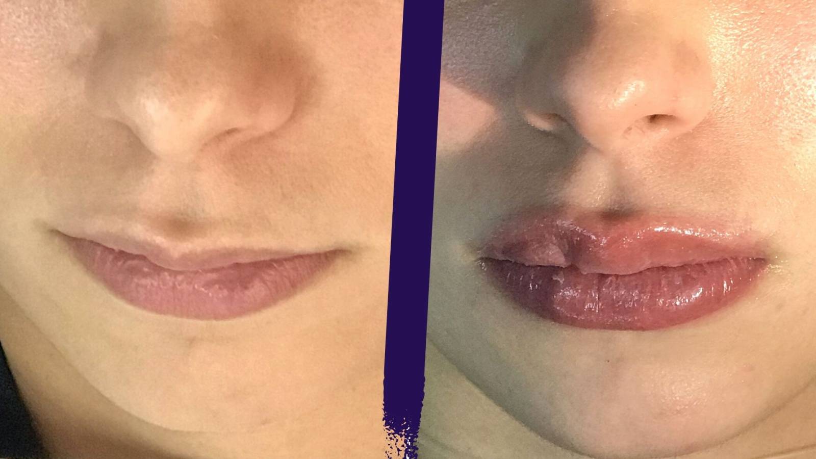 Bénéficiez d'un maquillage permanent de la bouche à Lyon