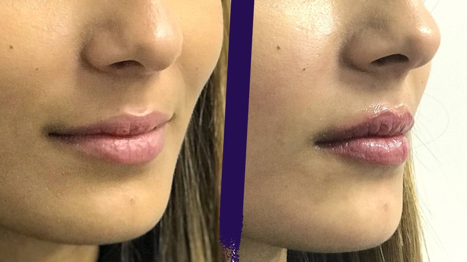 optez pour une prestation de maquillage permanent de la bouche à Lyon