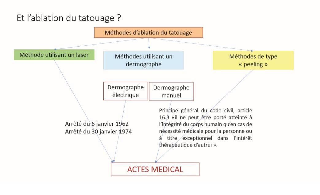 est ce que le détatouage ets autorisé en France?