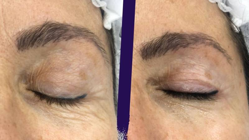 Bénéficiez d'un maquillage permanent des yeux à Lyon