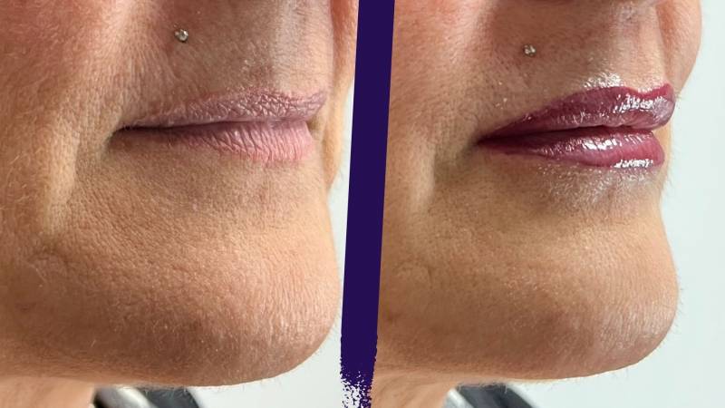 prestation de maquillage permanent de la bouche à Lyon